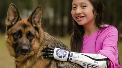 Bella-with-her-star-wars-style-bionic-arm