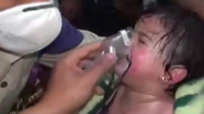 A Syrian girl receiving treatment after an alleged chemical attack in Sarmin, Syria