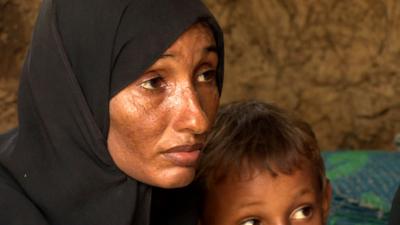 A woman displaced by the crisis in Yemen