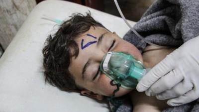 Child being treated for suspected chemical attack