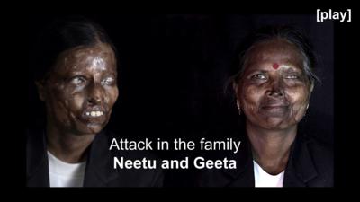 Mother and daughter - acid attack victims