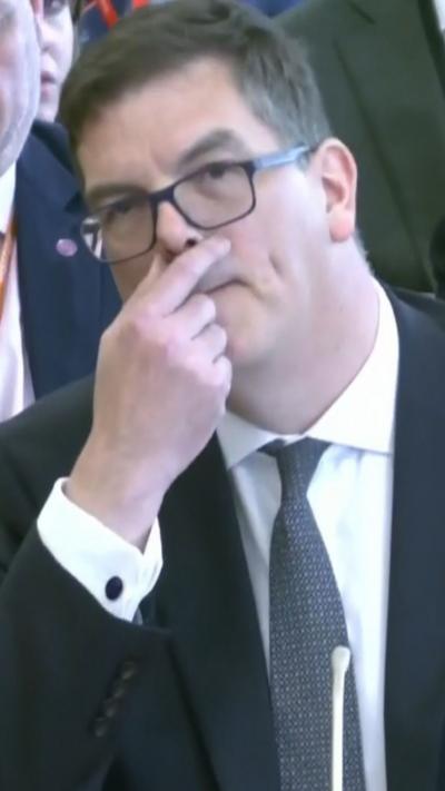 Robbins holds his hand near his face