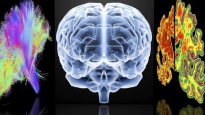 Computer images depicting brains