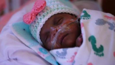 Saybie in hospital as a premature baby