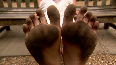 Dirty feet