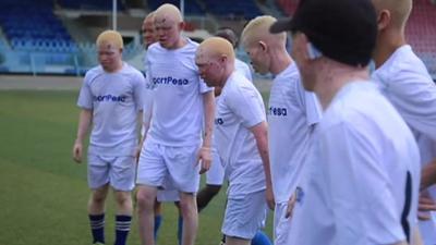 Albino United line up in training