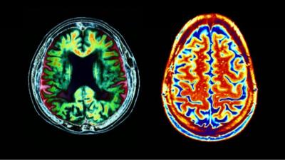 Brain scan images