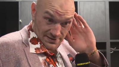 Tyson Fury