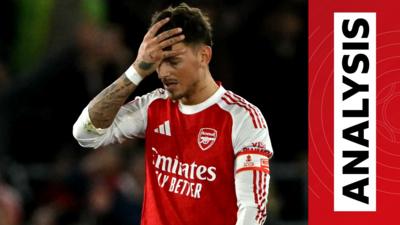 Ben White reacts with his hand on his head to Arsenal's loss against Southampton