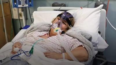 A woman in ICU