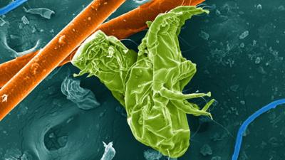 Dust mites