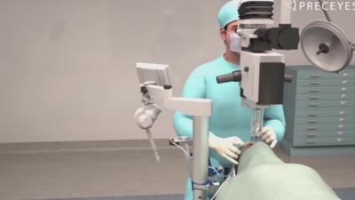 Eye surgery