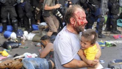 An injured migrant, with blood on his face, holds a child during clashes with Hungarian riot police at the border crossing with Serbia in Roszke