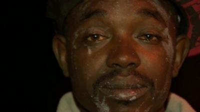 Close up of migrant in Calais with watering eyes after being pepper-sprayed by French police