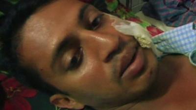 Injured Dhaka police officer