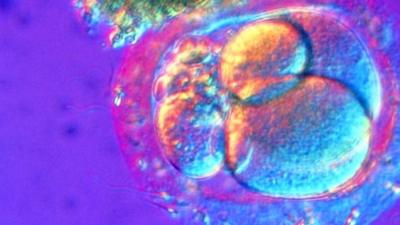 Light micrograph of fertilized human egg cell