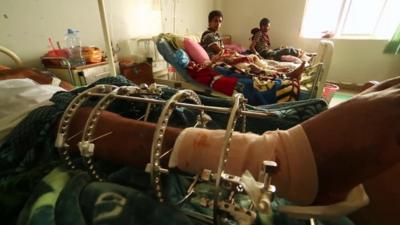 Patients in hospital in Yemen