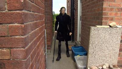 Anorexic Amy Ellis is trying to raise money for treatment not available on the NHS in Wales