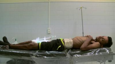 Patient in hospital