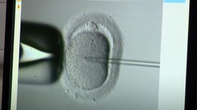 IVF