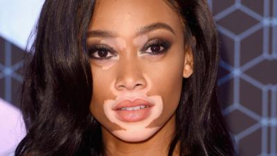 Model Winnie Harlow