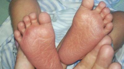 The feet of 'Annie's' baby boy