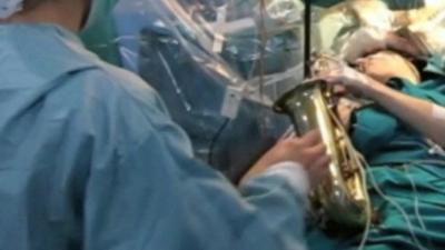 Carlos Aguilera plays the saxophone whilst have surgery