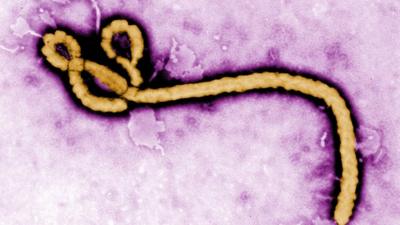 Ebola virus