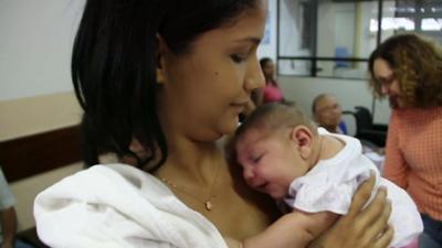 Baby with microcephaly in Brazil