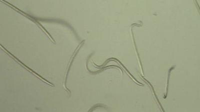 Hookworm larvae under a microscope