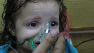 A young girl receiving oxygen after the attack