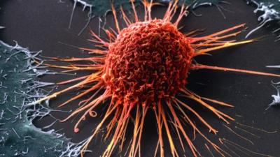 Cervical cancer cell