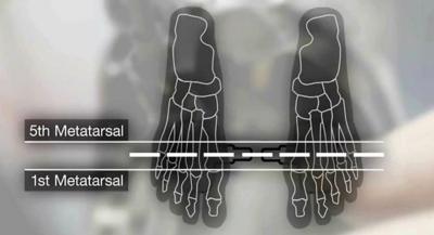 British Cycling's guide to setting up your cleats correctly