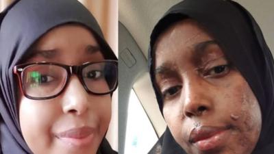 Two images of Zeinab, before and after the attack