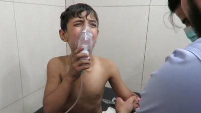 A boy is treated for breathing difficulties