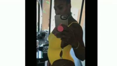 Serena Williams' pregnancy