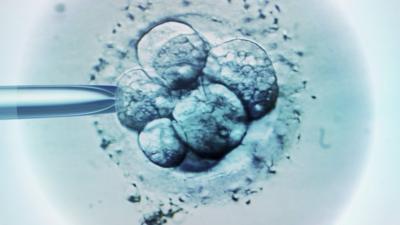 IVF treatment under the microscope