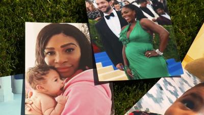 Serena Williams 'family album' photographs