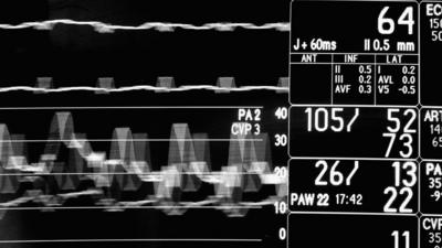 Heart monitor