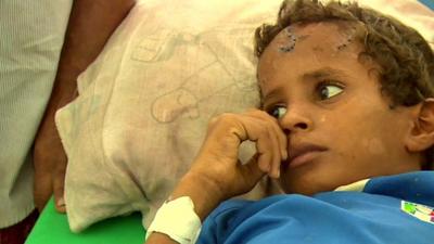 Close up of Yemeni boy, Omar, who is in constant pain after being injured in a landmine blast