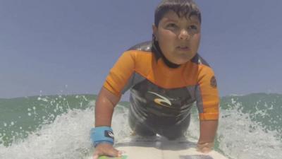 boy with visibly disabled hand on surfboard out at sea