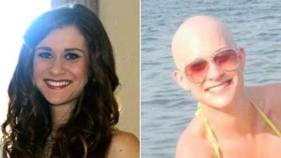 Imogen Proctor before and after her hair loss