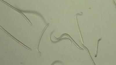 Hookworm larvae under a microscope