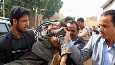 Wounded boy in Yemen