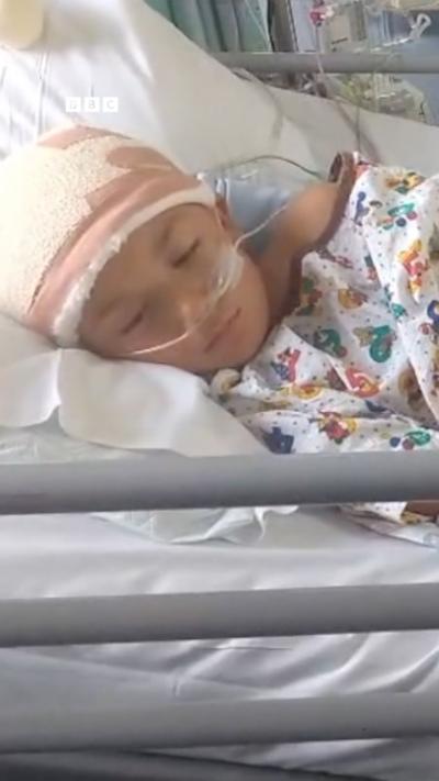 A young boy lying in hospital bed with head bandages