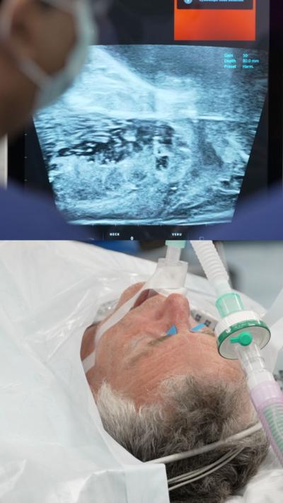 Top half of the photo is an ultrasound and the bottom half is a man during an operation.