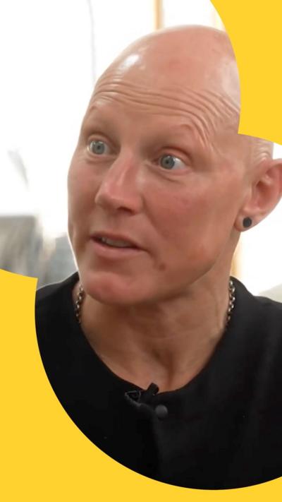 Heather Fisher wears a black tshirt and has no hair