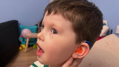 Isaac shows off his orange and blue hearing aid. He has turned his head to the side and has his mouth open. Isaac is a young boy with short, brown hair. He is sitting on a chair in front of a blue wall.
