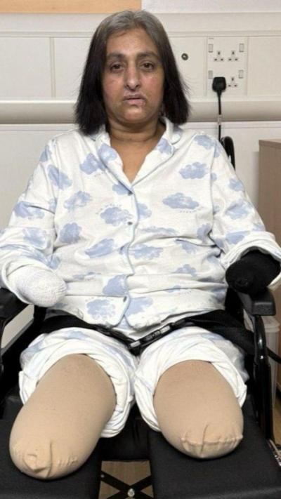 A woman in a white pyjama top with purple clouds. She has dark hair and is sat in a wheelchair after a double leg amputation