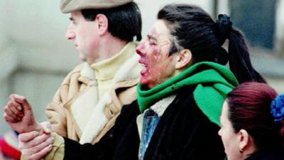 An injured woman following a mortar attack on an open air market in Sarajevo